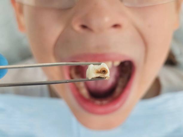Best Mobile Emergency Dentist in Boston, MA
